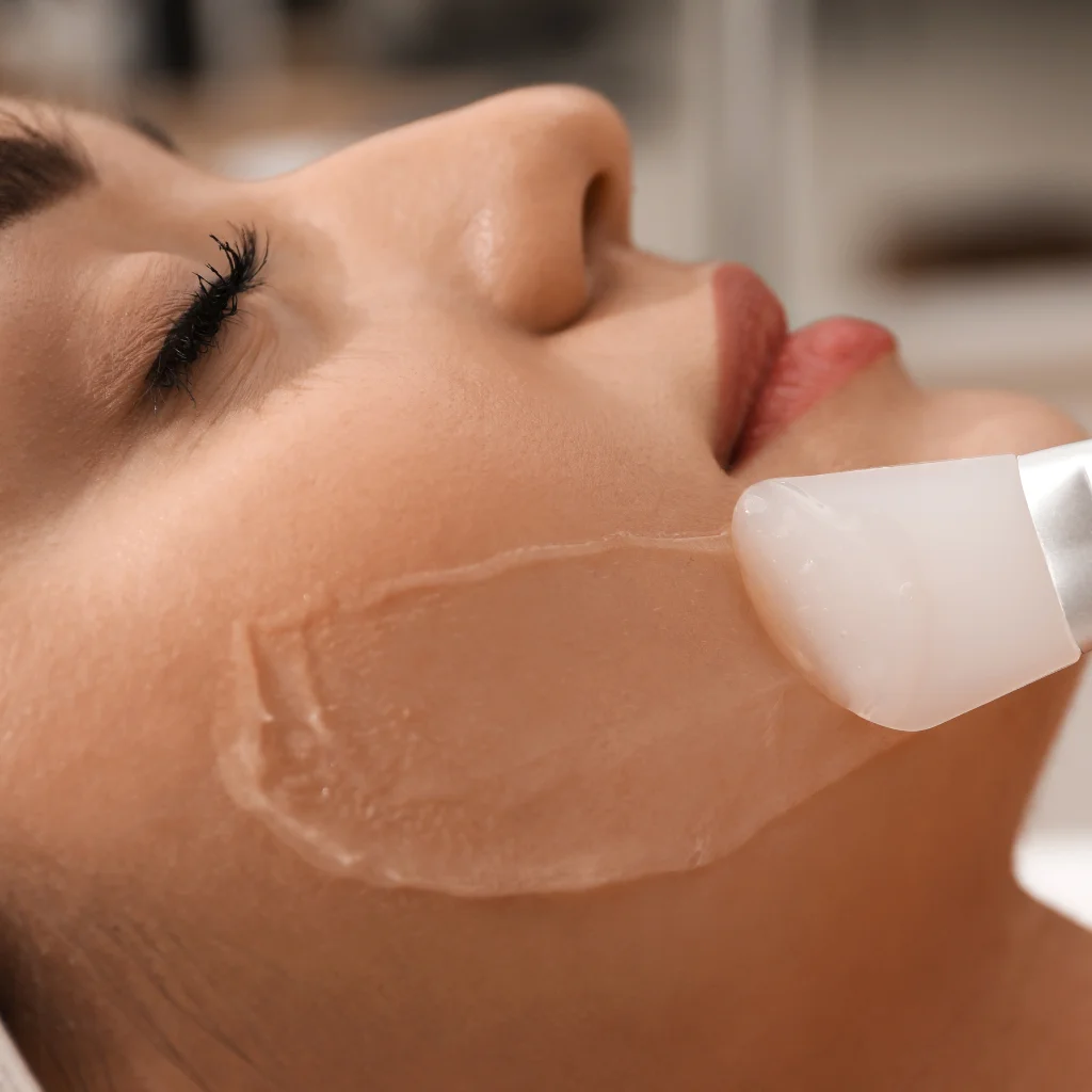 Peeling Químico